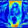 Biomedical Imaging